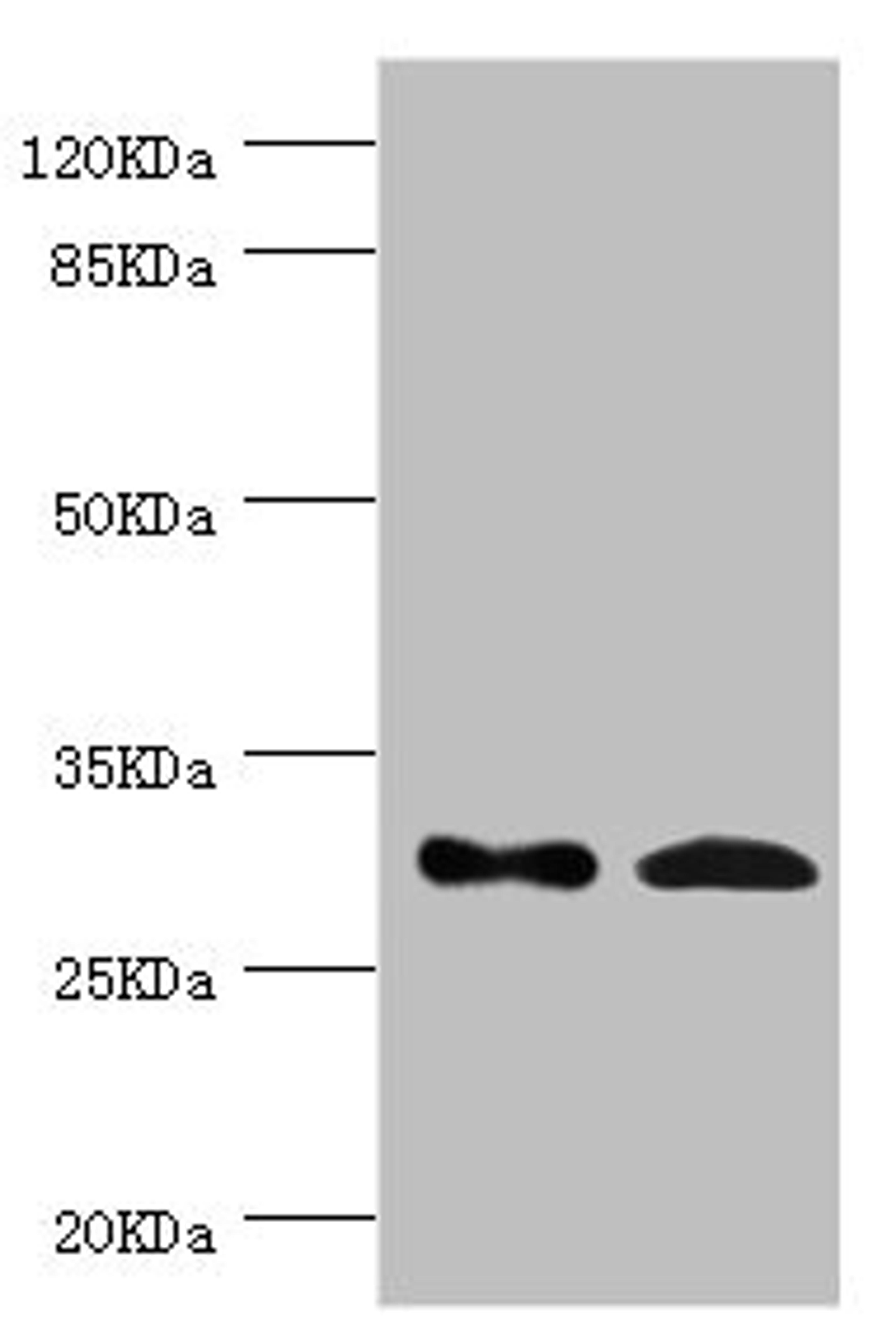 Western blot. All lanes: ZWINT antibody at 8.93ug/ml. Lane 1: Hela whole cell lysate. Lane 2: Mouse liver tissue. Secondary. Goat polyclonal to rabbit IgG at 1/10000 dilution. Predicted band size: 32, 26 kDa. Observed band size: 32 kDa. 