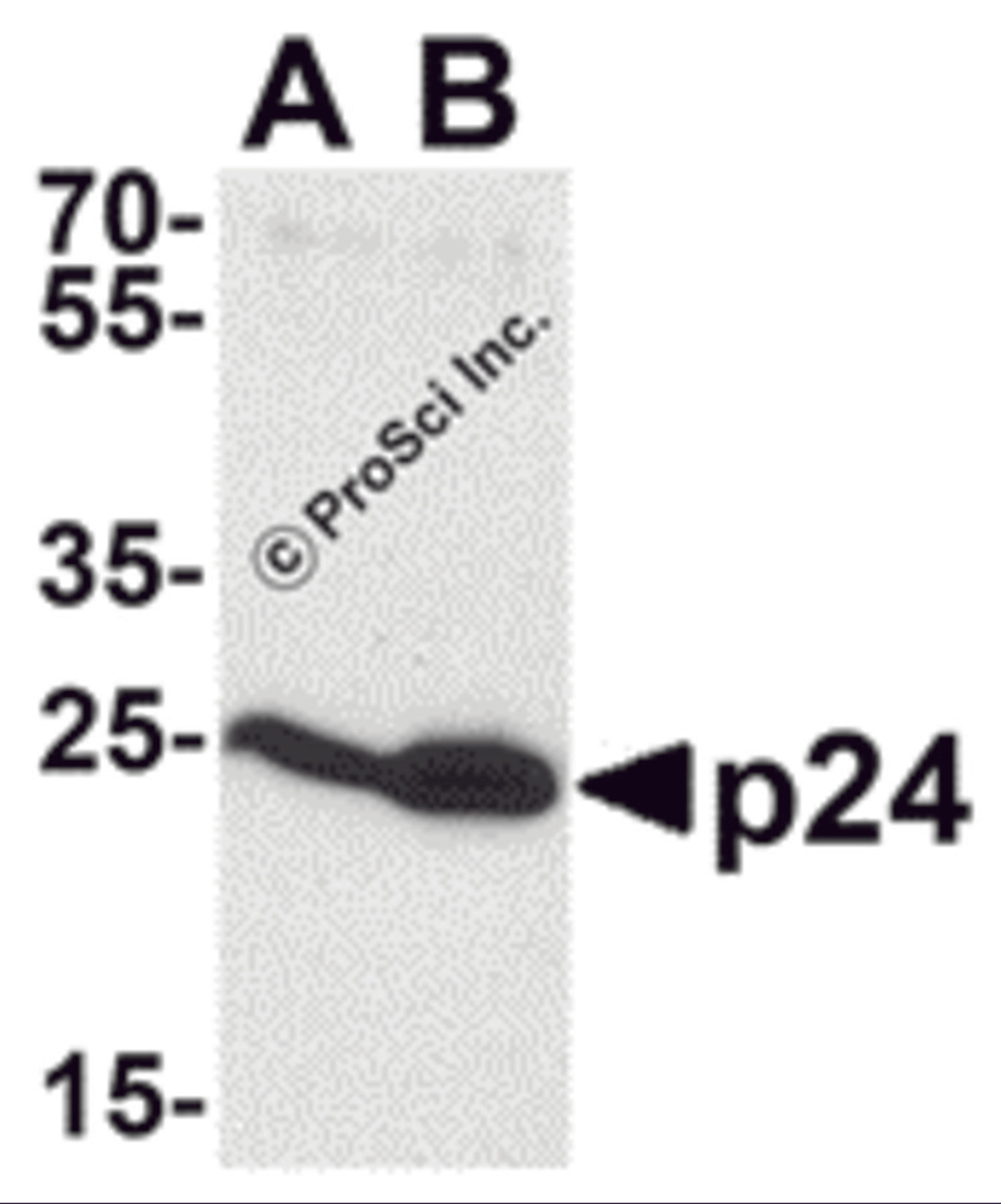 Western blot analysis of p24 using p24 antibody at 0.5 &#956;g/mL to detect (A) 2 ng and (B) 10 ng of recombinant HIV-1 p24.