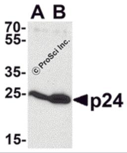 Western blot analysis of p24 using p24 antibody at 0.5 μg/mL to detect (A) 2 ng and (B) 10 ng of recombinant HIV-1 p24.