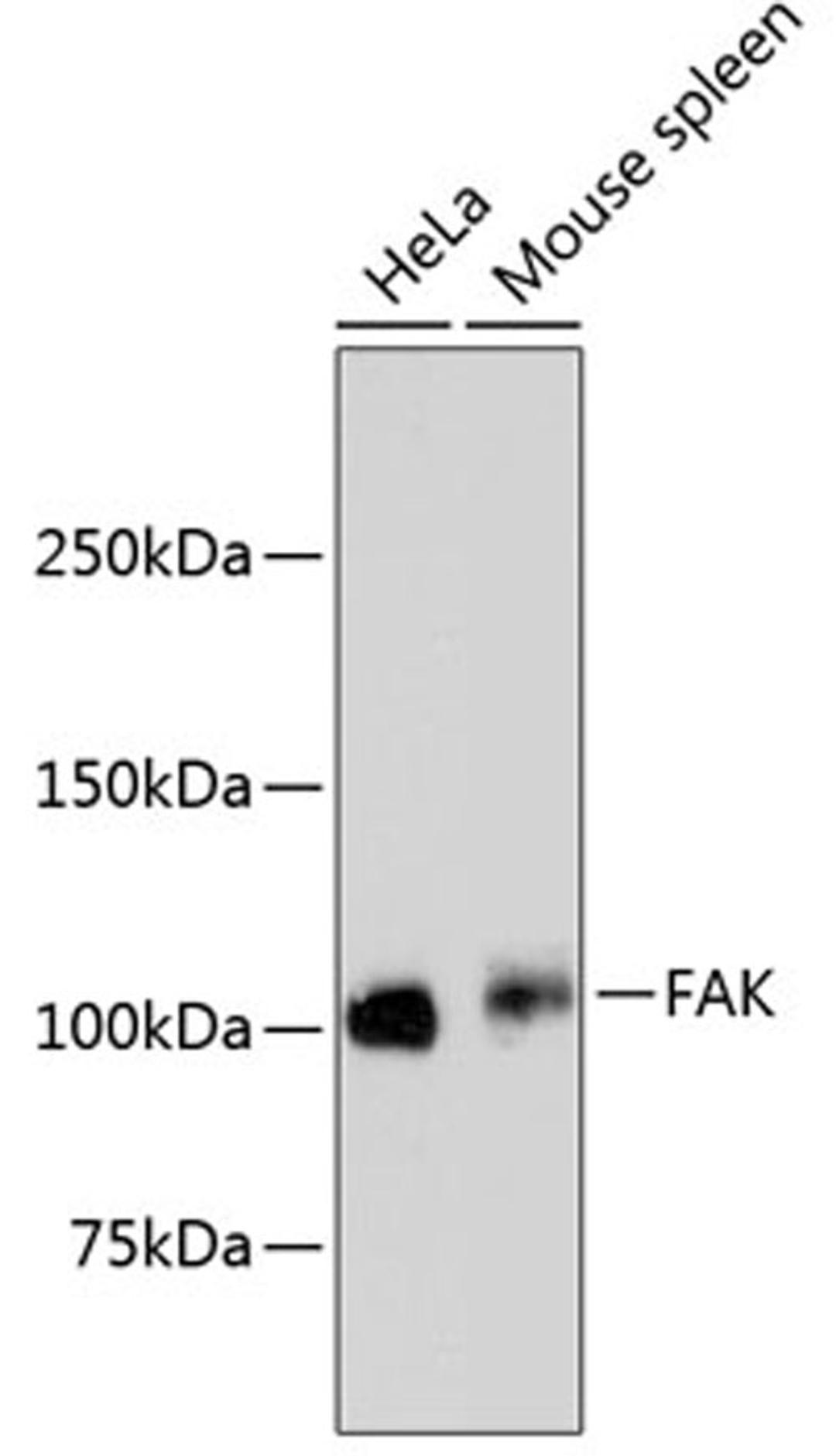 Western blot - FAK antibody (A11131)