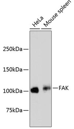 Western blot - FAK antibody (A11131)