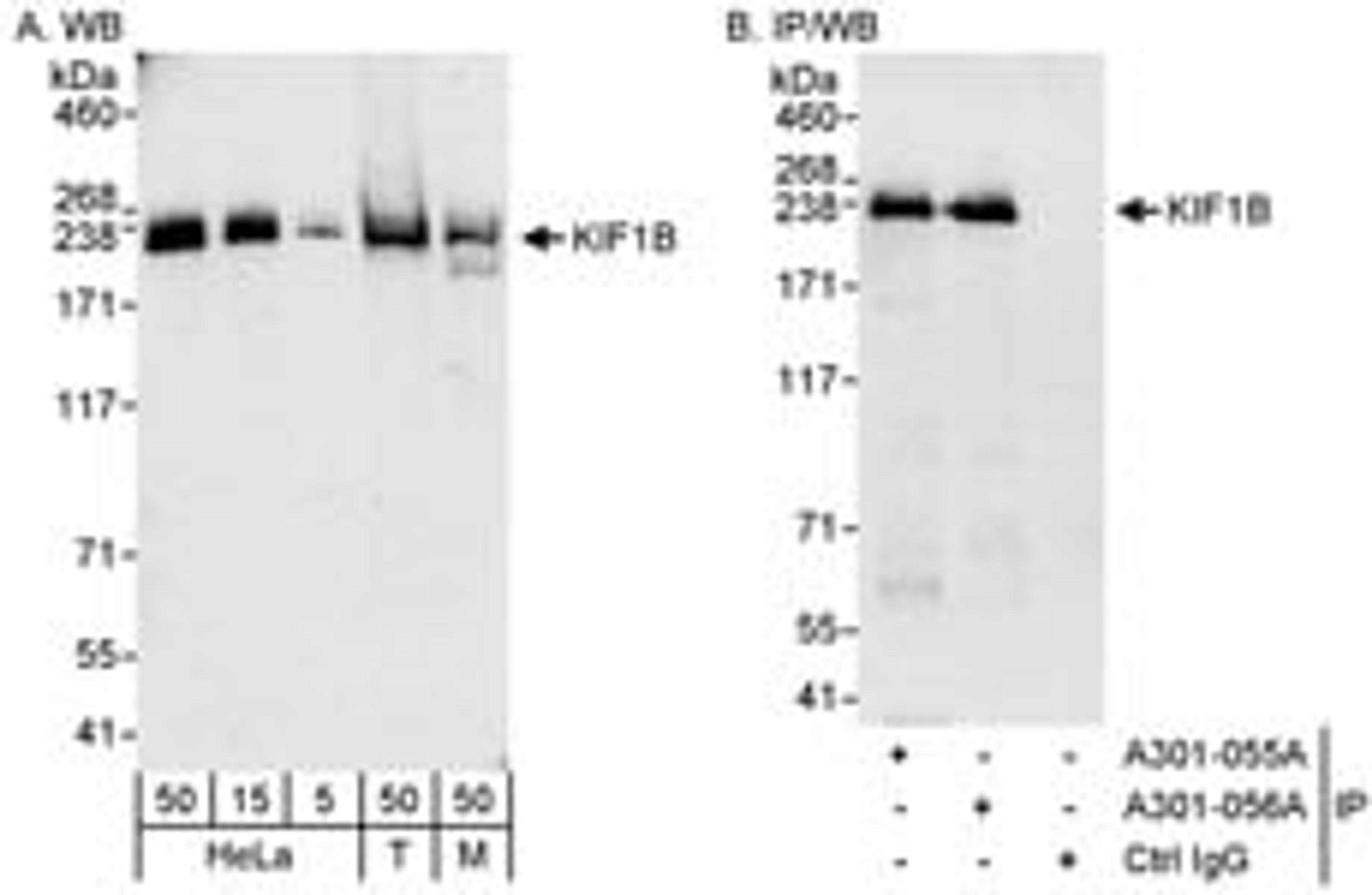 Detection of human and mouse KIF1B by western blot (h&m) and immunoprecipitation (h).