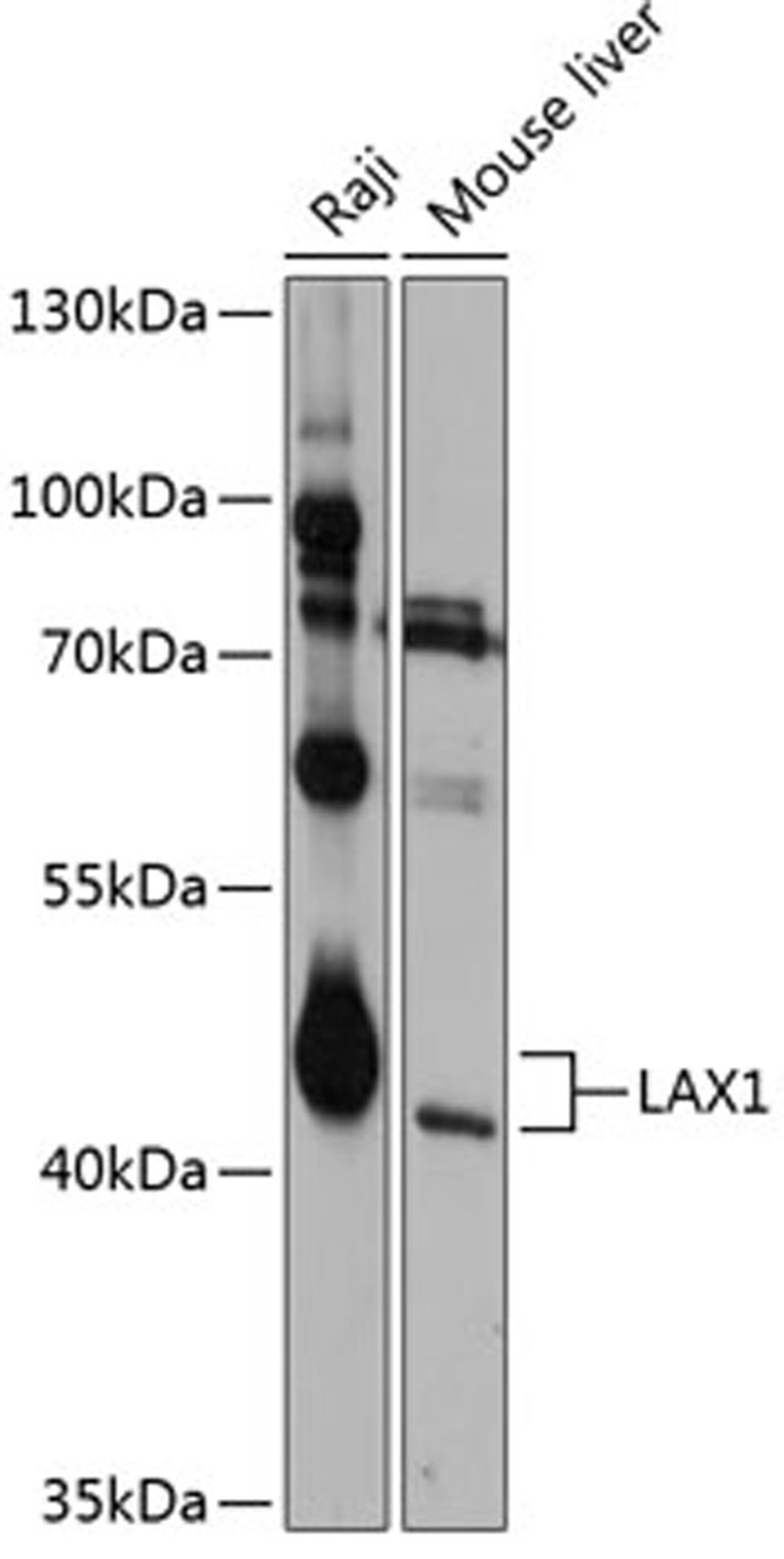 Western blot - LAX1 antibody (A12218)