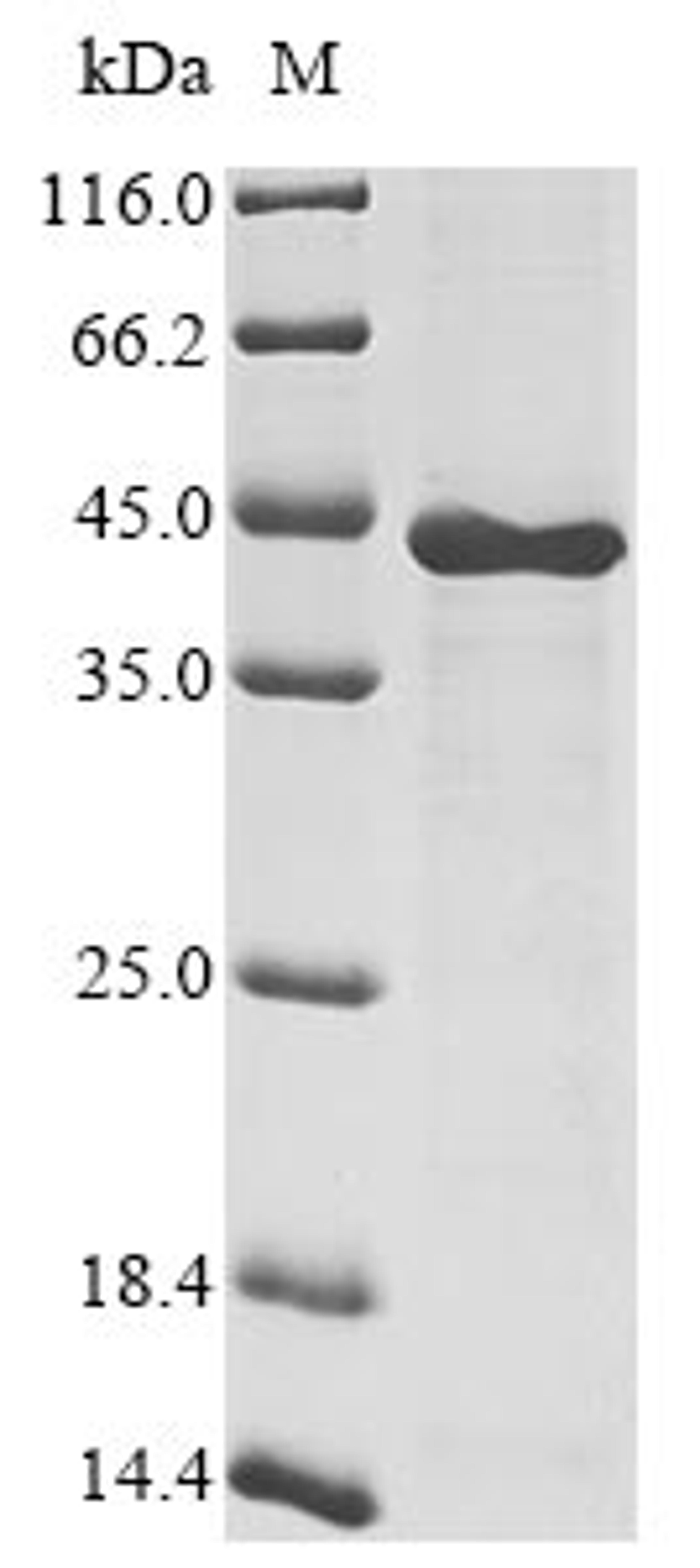(Tris-Glycine gel) Discontinuous SDS-PAGE (reduced) with 5% enrichment gel and 15% separation gel.