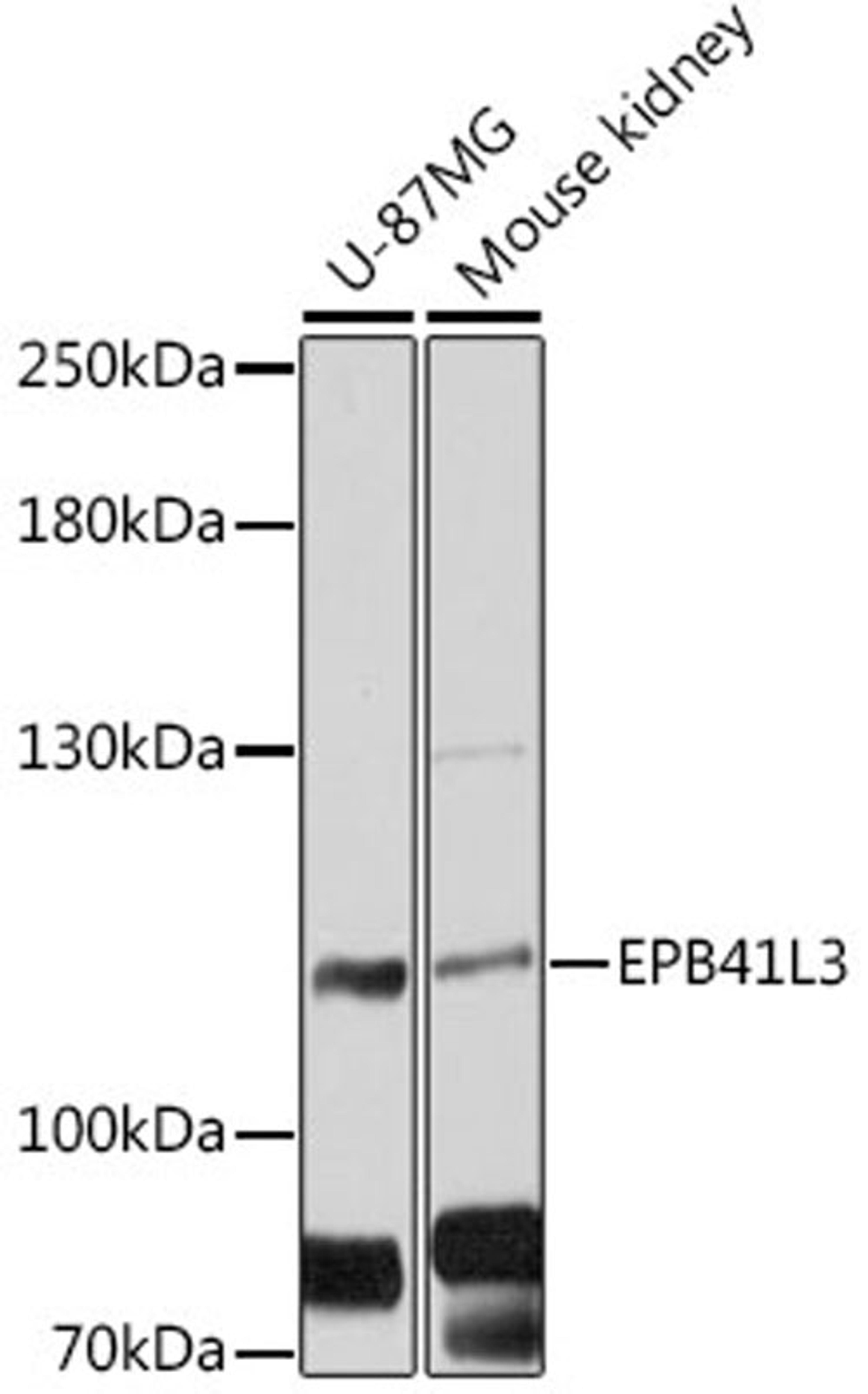 Western blot - EPB41L3 antibody (A12759)