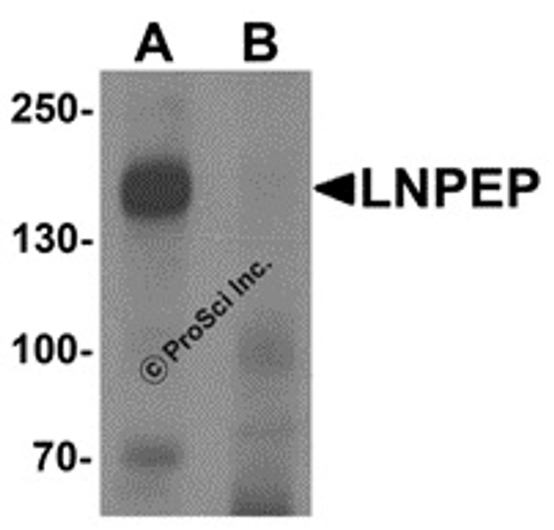 Western blot analysis of LNPEP in human lung tissue lysate with LNPEP antibody at 1 μg/mL in (A) the absence and (B) the presence of blocking peptide.