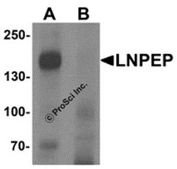 Western blot analysis of LNPEP in human lung tissue lysate with LNPEP antibody at 1 μg/mL in (A) the absence and (B) the presence of blocking peptide.