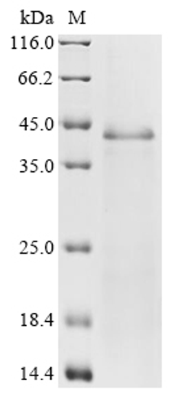 (Tris-Glycine gel) Discontinuous SDS-PAGE (reduced) with 5% enrichment gel and 15% separation gel.