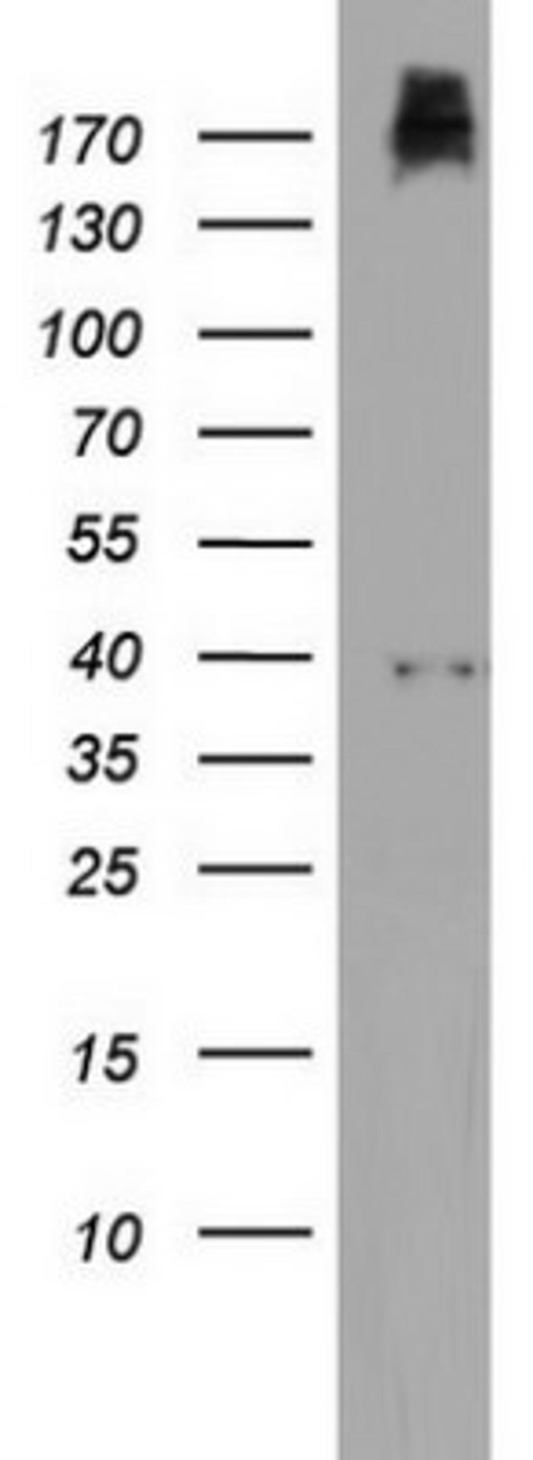 Western Blot: PIK3C2A Antibody (3H2) [NBP2-46395] - Analysis of HT29 cell lysate (35ug) by using PIK3C2A monoclonal antibody.