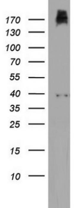 Western Blot: PIK3C2A Antibody (3H2) [NBP2-46395] - Analysis of HT29 cell lysate (35ug) by using PIK3C2A monoclonal antibody.