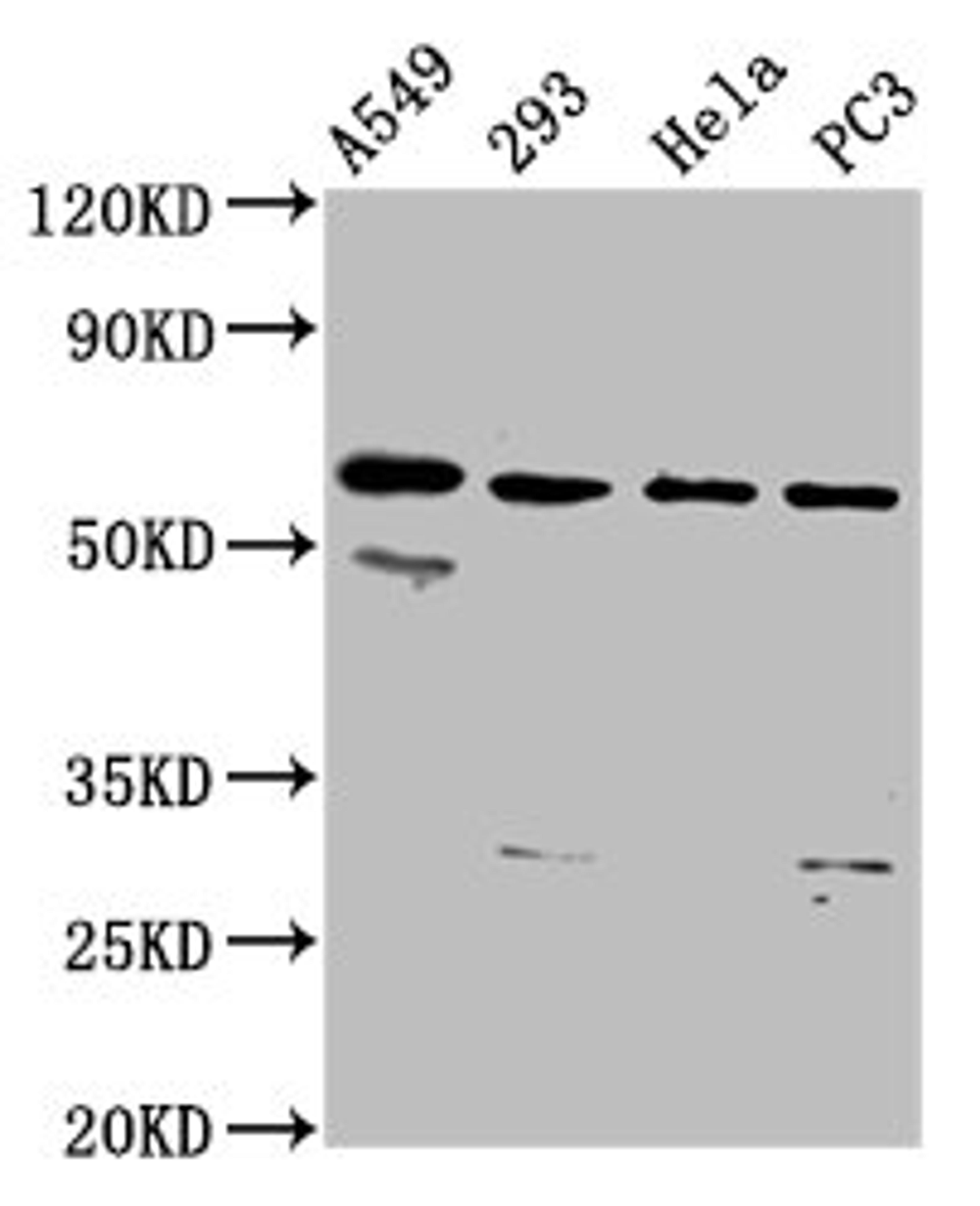 Western Blot. Positive WB detected in: A549 whole cell lysate, 293 whole cell lysate, Hela whole cell lysate, PC-3 whole cell lysate. All lanes: DDX28 antibody at 6.1µg/ml. Secondary. Goat polyclonal to rabbit IgG at 1/50000 dilution. Predicted band size: 60 kDa. Observed band size: 60 kDa