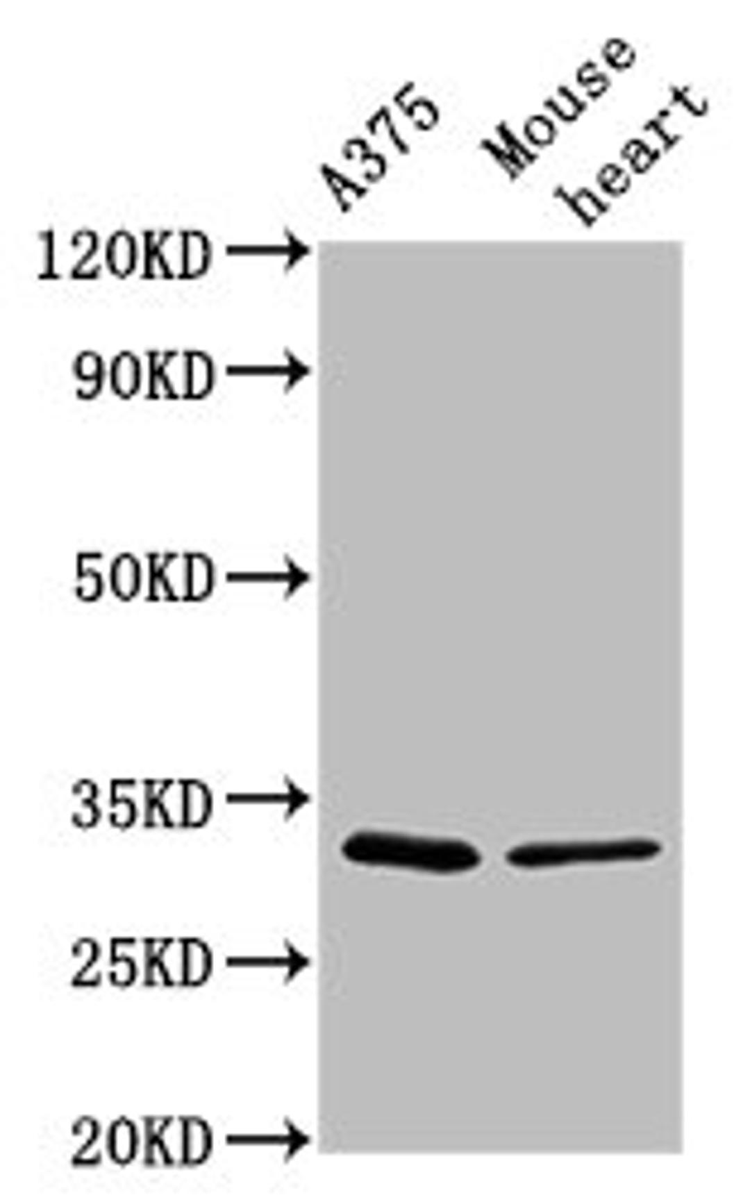 Western Blot. Positive WB detected in: A375 whole cell lysate, Mouse heart tissue. All lanes: TIMMDC1 antibody at 2.9µg/ml. Secondary. Goat polyclonal to rabbit IgG at 1/50000 dilution. Predicted band size: 33 kDa. Observed band size: 33 kDa