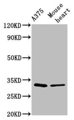 Western Blot. Positive WB detected in: A375 whole cell lysate, Mouse heart tissue. All lanes: TIMMDC1 antibody at 2.9µg/ml. Secondary. Goat polyclonal to rabbit IgG at 1/50000 dilution. Predicted band size: 33 kDa. Observed band size: 33 kDa