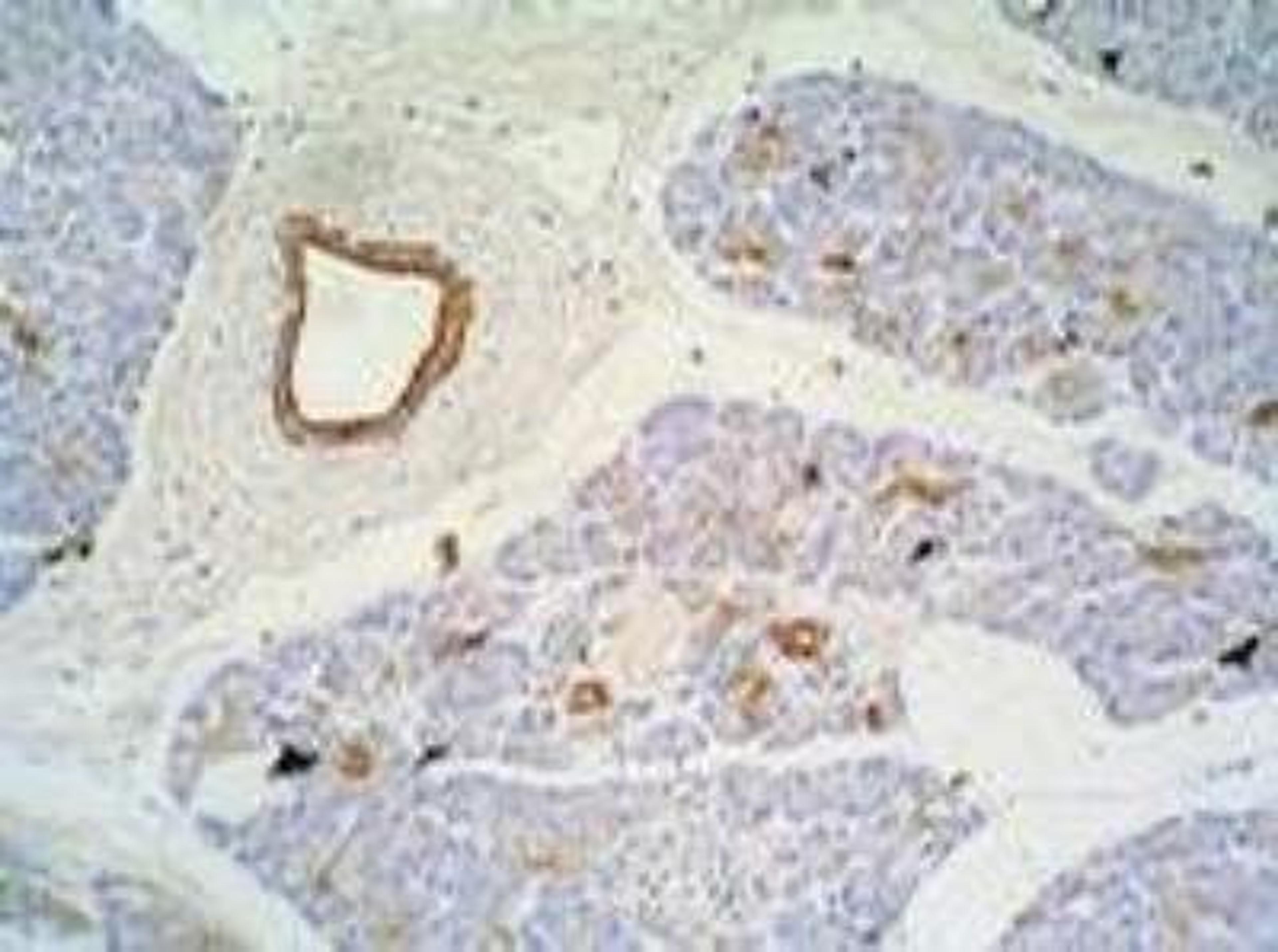 Immunohistochemistry: Cytokeratin 7/17 Antibody (C-46) [NB500-352] - Fig. 1. Immunohistochemistry staining of pancreas (paraffin-embedded sections) with anti-Cytokeratin 7/17 Antibody (C-46).