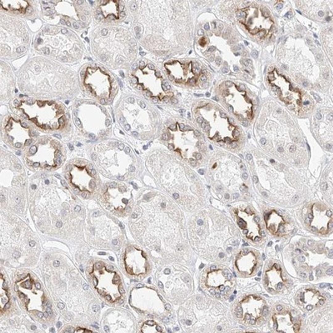 Immunohistochemistry-Paraffin: KCNJ1 Antibody [NBP1-82874] - Staining of human kidney shows distinct membranous positivity in distal renal tubules.