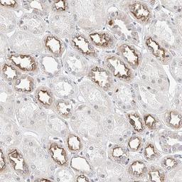 Immunohistochemistry-Paraffin: KCNJ1 Antibody [NBP1-82874] - Staining of human kidney shows distinct membranous positivity in distal renal tubules.