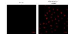 Immunofluorescence: Thymine Dimer Antibody (H3) [NB600-1141] - analysis of Thymine Dimer in human keratinocytes using anti-Thymine Dimer antibody. Image from verified customer review.