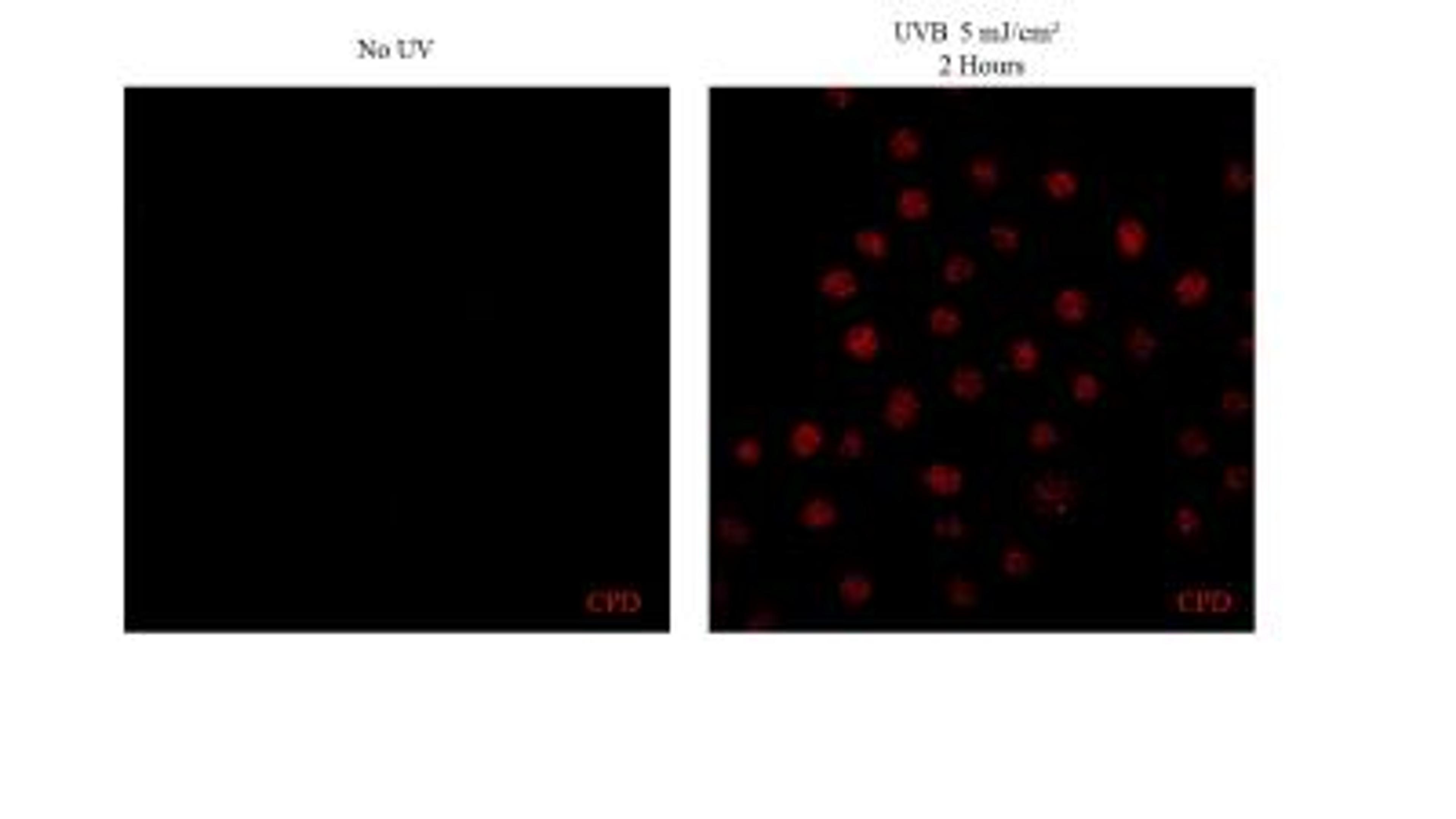 Immunofluorescence: Thymine Dimer Antibody (H3) [NB600-1141] - analysis of Thymine Dimer in human keratinocytes using anti-Thymine Dimer antibody. Image from verified customer review.