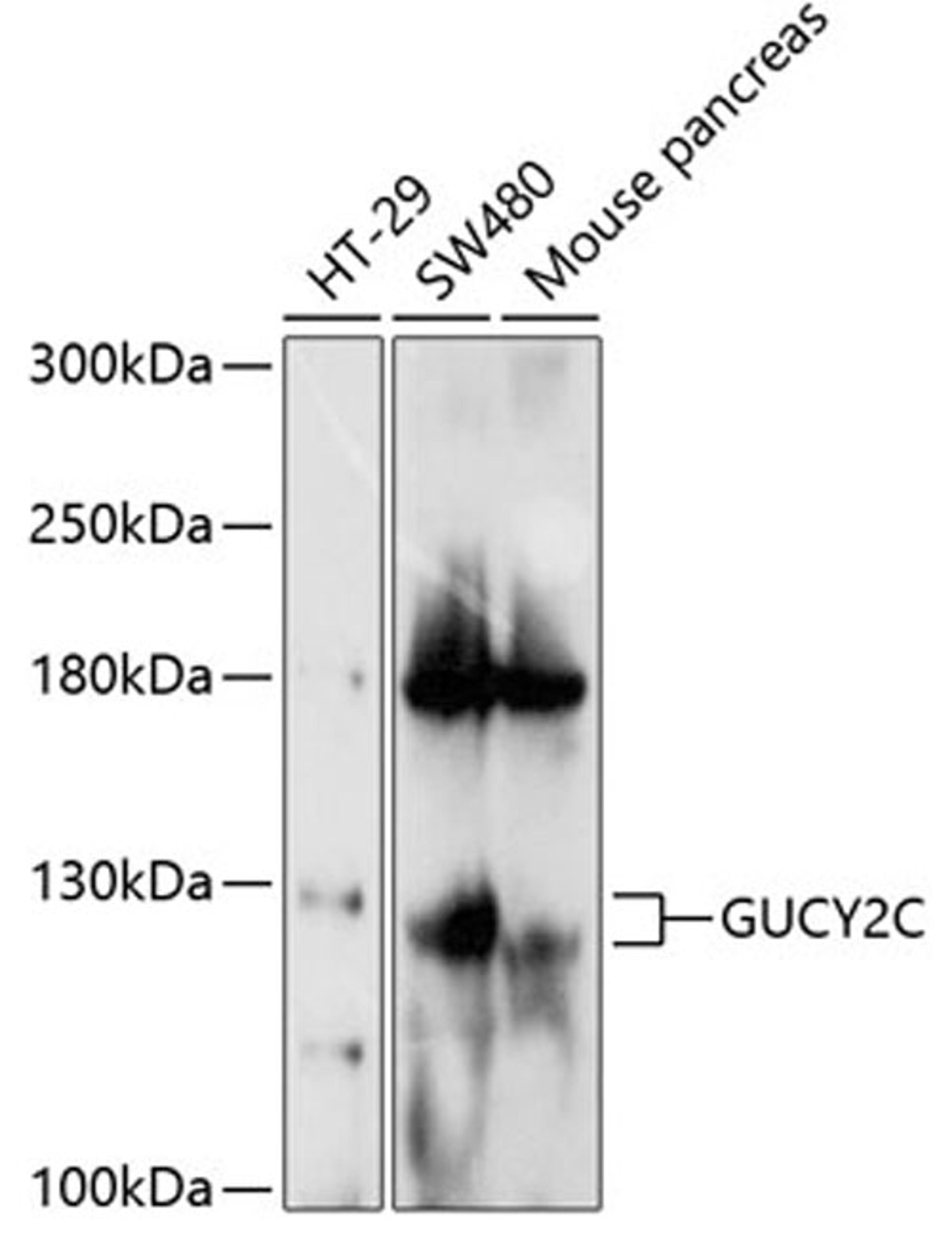 Western blot - GUCY2C antibody (A10562)