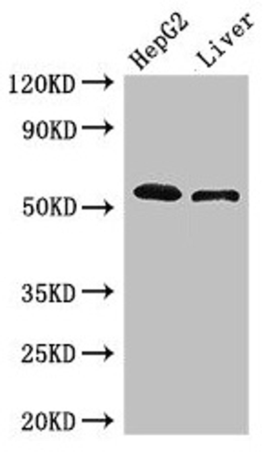 Western Blot. Positive WB detected in: HepG2 whole cell lysate, Mouse liver tissue. All lanes: SCARB2 antibody at 3µg/ml. Secondary. Goat polyclonal to rabbit IgG at 1/50000 dilution. Predicted band size: 55, 38 kDa. Observed band size: 55 kDa