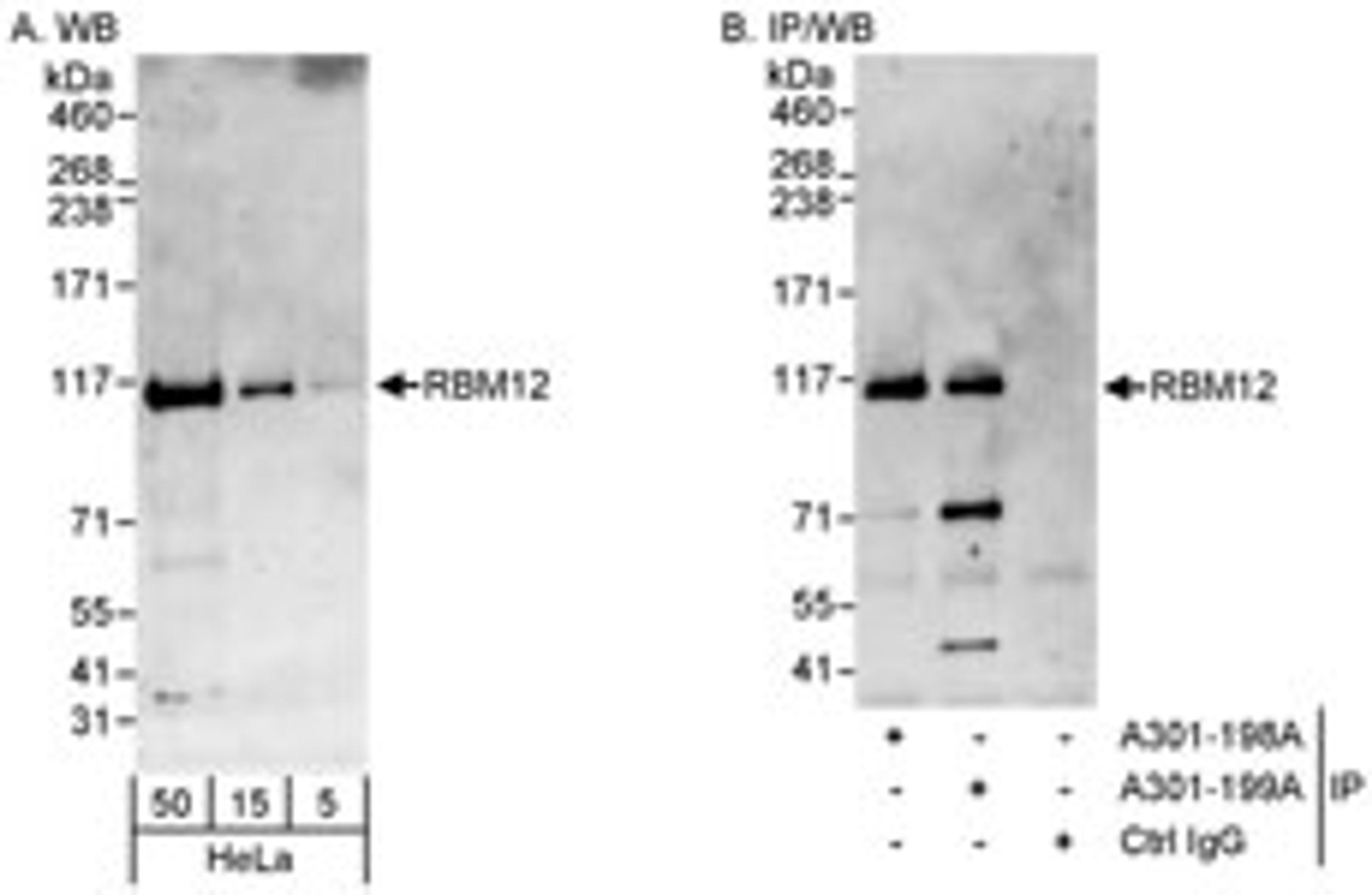 Detection of human RBM12 by western blot and immunoprecipitation.