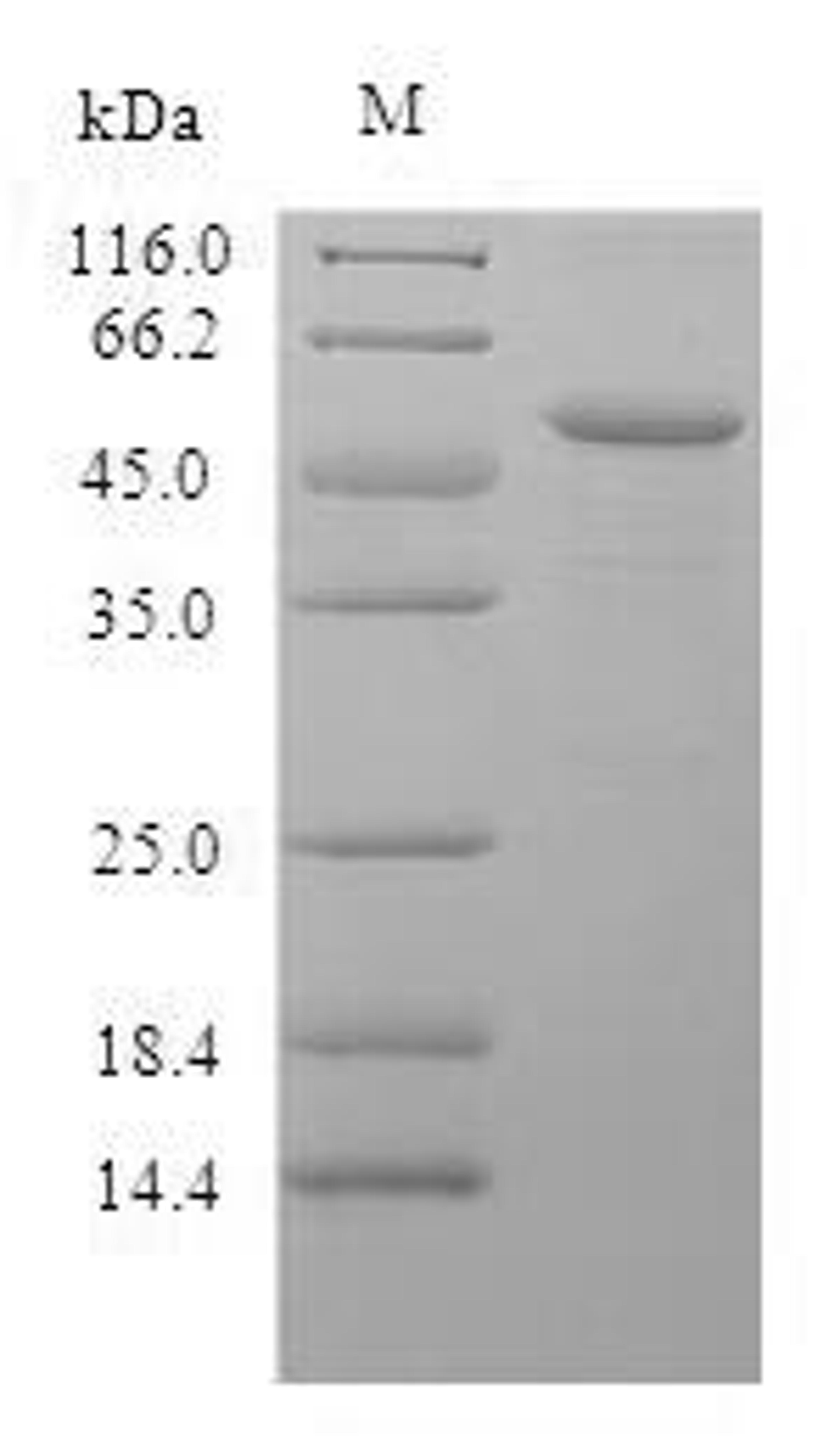 (Tris-Glycine gel) Discontinuous SDS-PAGE (reduced) with 5% enrichment gel and 15% separation gel.
