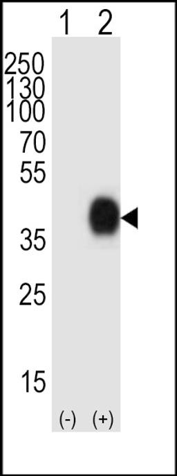 Western blot analysis of lysate from 293T cell line, using CD38 Antibody at 1:1000.