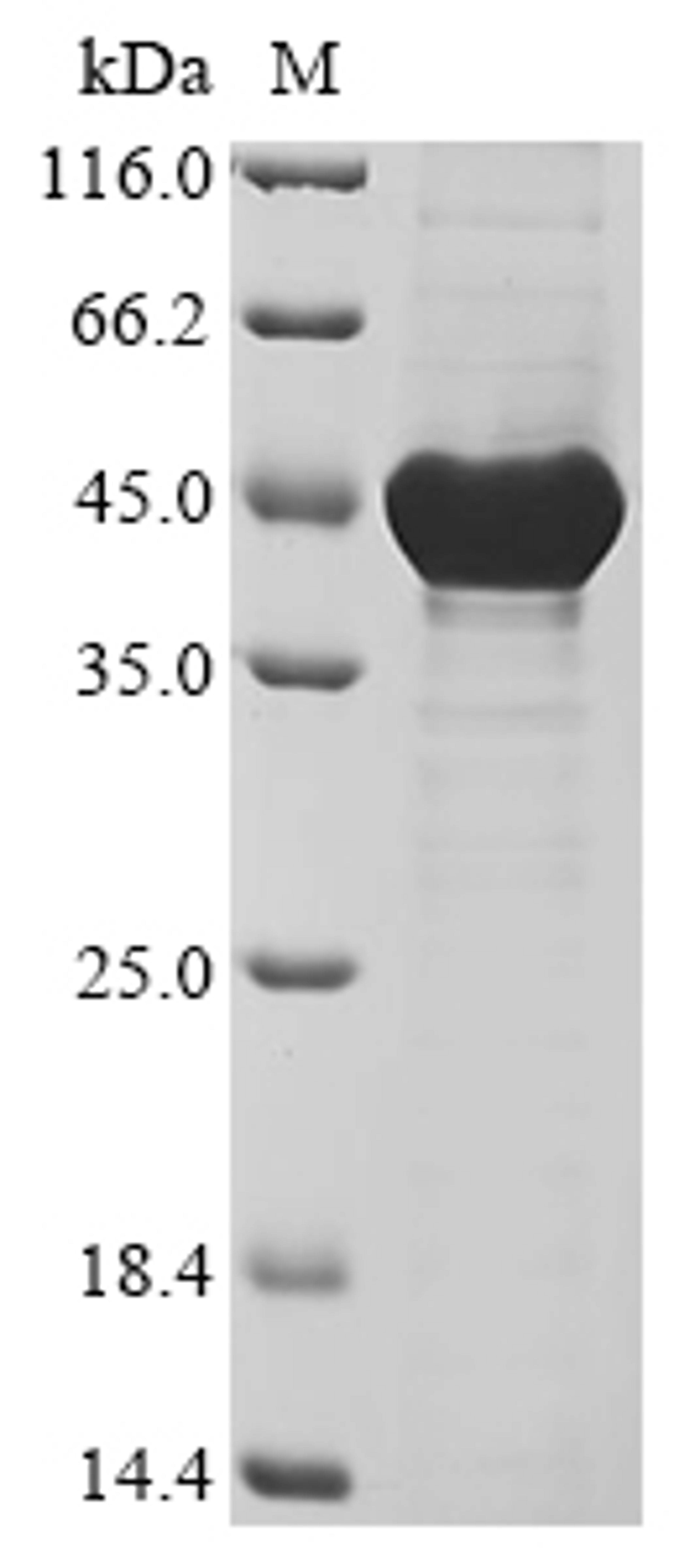 (Tris-Glycine gel) Discontinuous SDS-PAGE (reduced) with 5% enrichment gel and 15% separation gel.