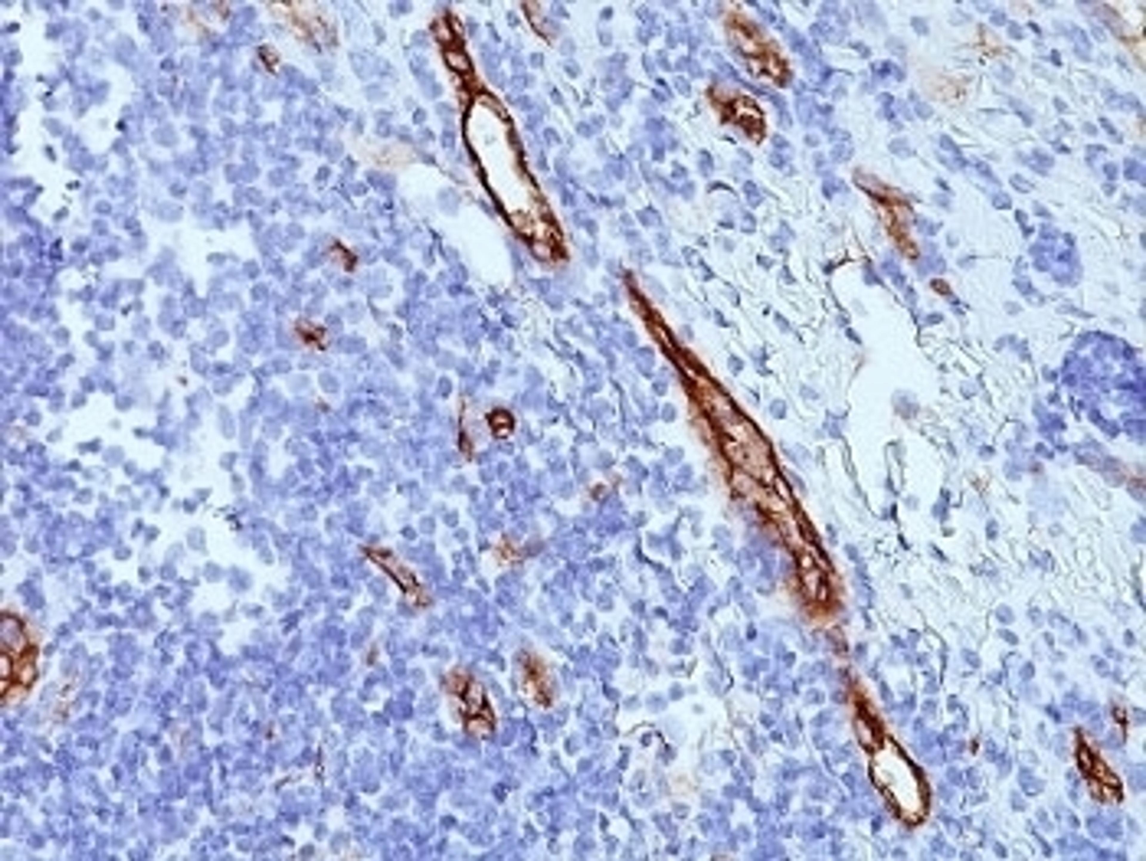 Formalin-fixed, paraffin-embedded human tonsil stained with anti-von Willebrand Factor antibody (SPM577)