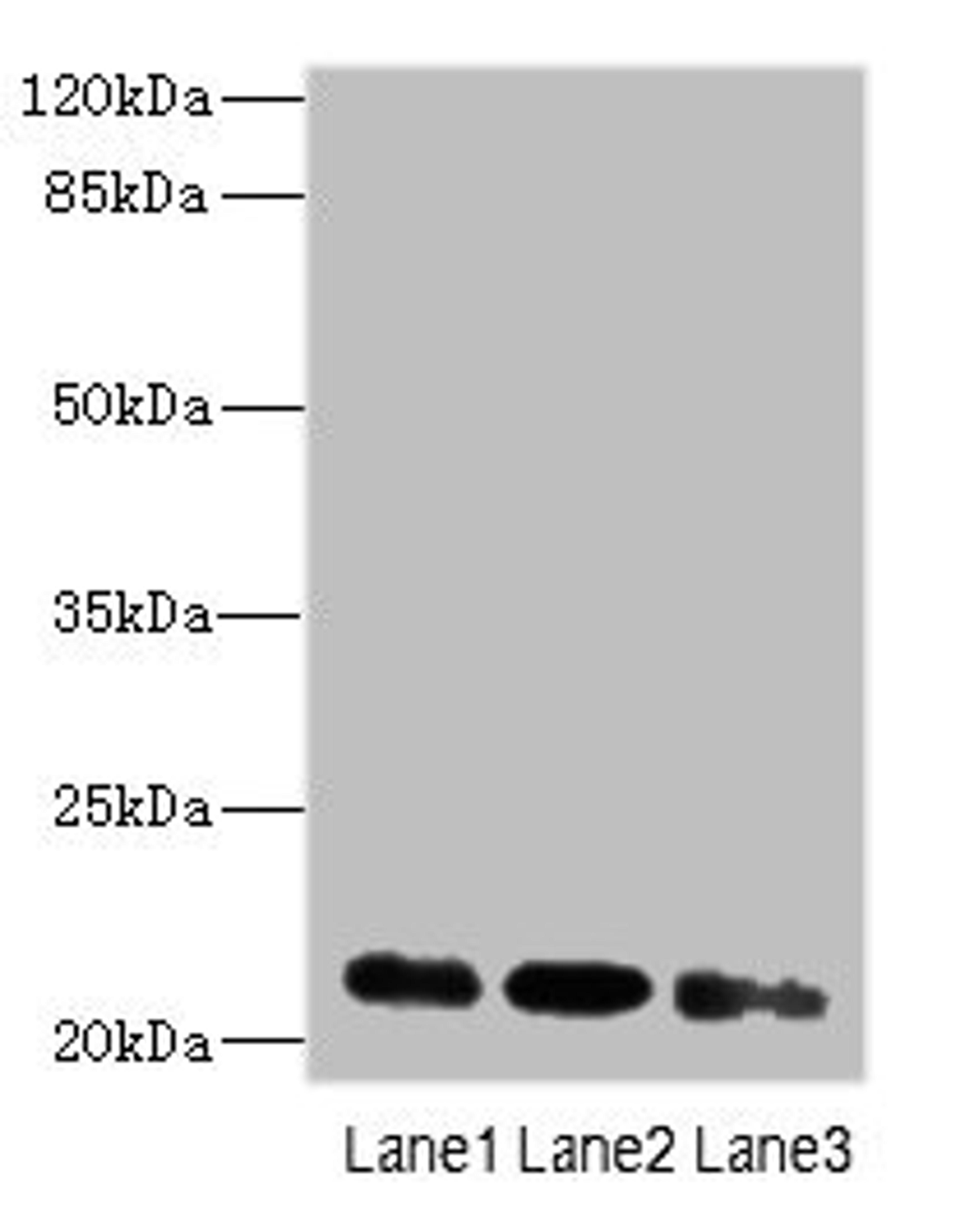 Western blot. All lanes: MRPL11 antibody at 16ug/ml. Lane 1: HepG2 whole cell lysate. Lane 2: Hela whole cell lysate. Lane 3: A549 whole cell lysate. Secondary. Goat polyclonal to rabbit IgG at 1/10000 dilution. Predicted band size: 21, 19, 20 kDa. Observed band size: 21 kDa. 