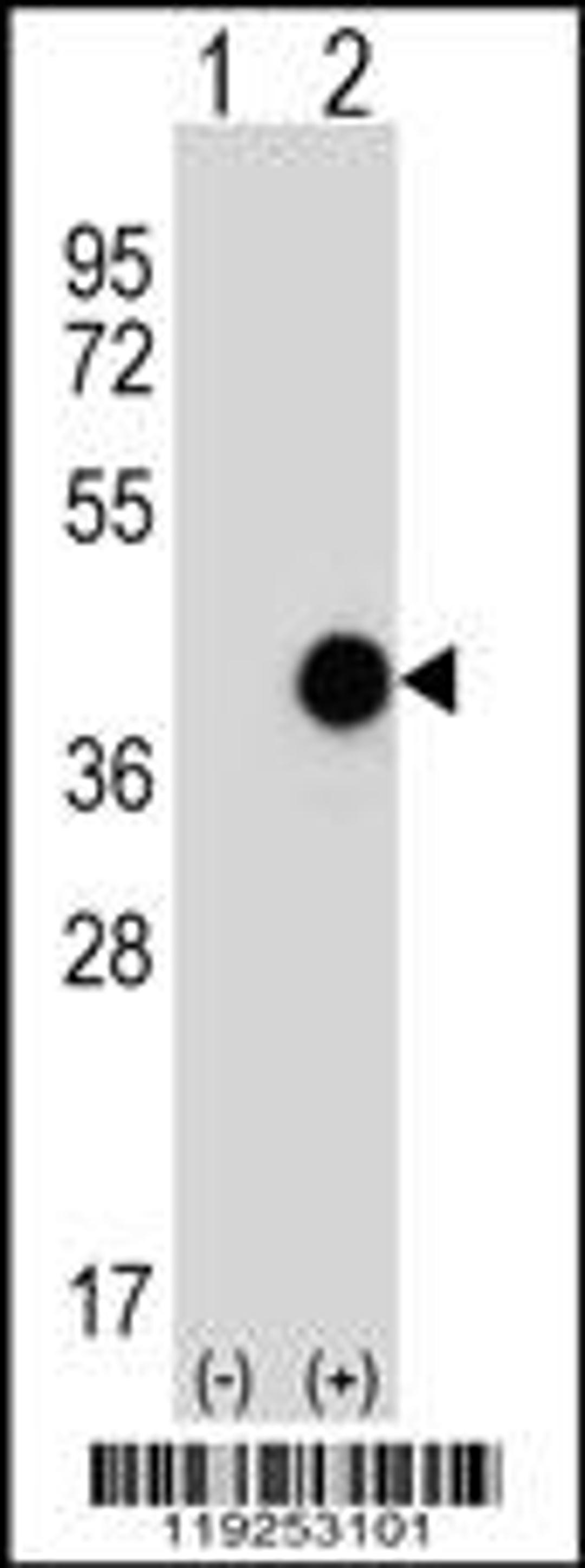 Western blot analysis of CTSK using rabbit polyclonal using 293 cell lysates (2 ug/lane) either nontransfected (Lane 1) or transiently transfected (Lane 2) with the CTSK gene.