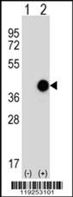 Western blot analysis of CTSK using rabbit polyclonal using 293 cell lysates (2 ug/lane) either nontransfected (Lane 1) or transiently transfected (Lane 2) with the CTSK gene.