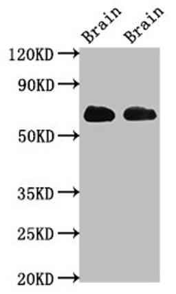 Western Blot. Positive WB detected in: Rat brain tissue, Mouse brain tissue. All lanes: SLC1A2 antibody at 3.2ug/ml. Secondary. Goat polyclonal to rabbit IgG at 1/50000 dilution. Predicted band size: 63, 62 kDa. Observed band size: 63 kDa.