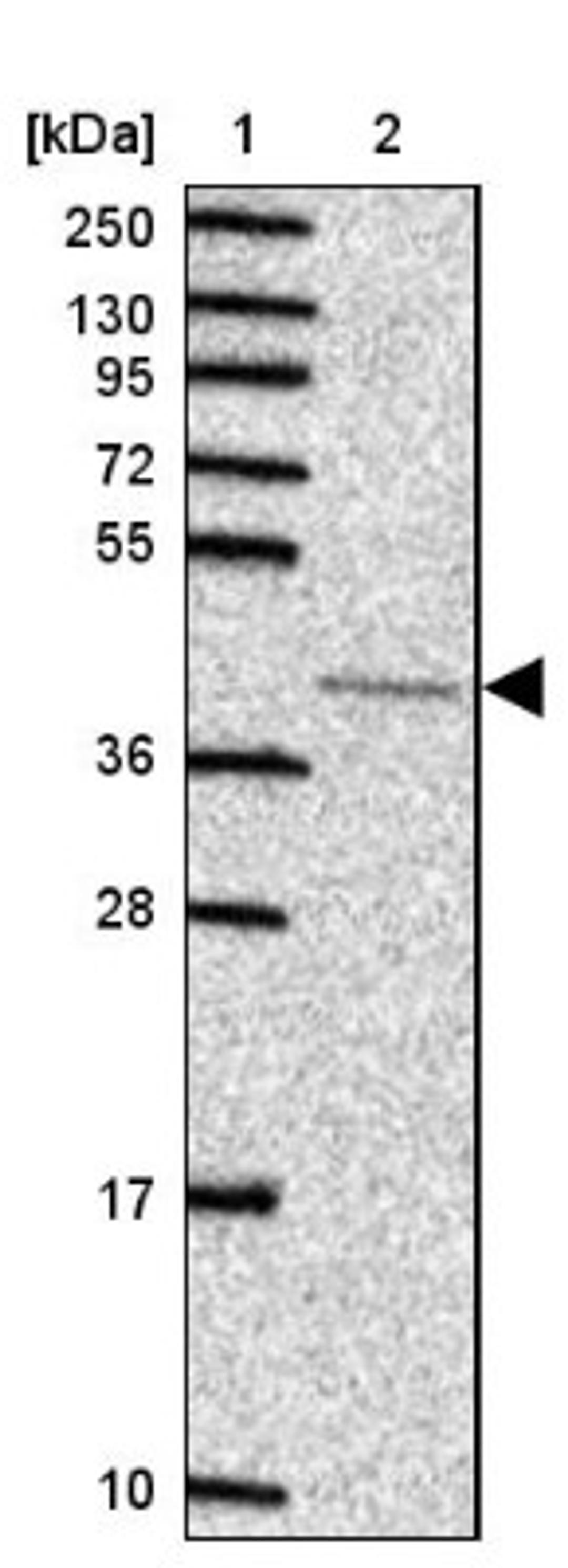 Western Blot: p38 alpha Antibody [NBP2-37934] - Lane 1: Marker [kDa] 250, 130, 95, 72, 55, 36, 28, 17, 10<br/>Lane 2: RT-4