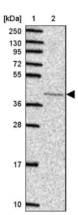 Western Blot: p38 alpha Antibody [NBP2-37934] - Lane 1: Marker [kDa] 250, 130, 95, 72, 55, 36, 28, 17, 10<br/>Lane 2: RT-4