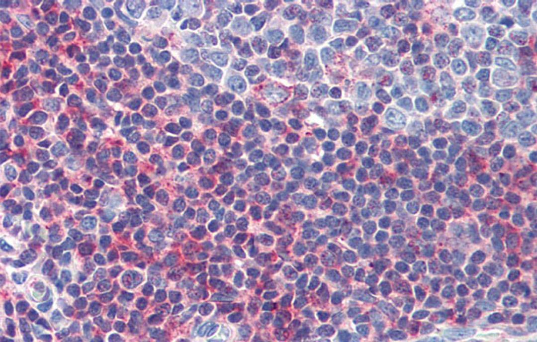 Antibody used in IHC on Human Tonsil at 5.0 ug/ml.