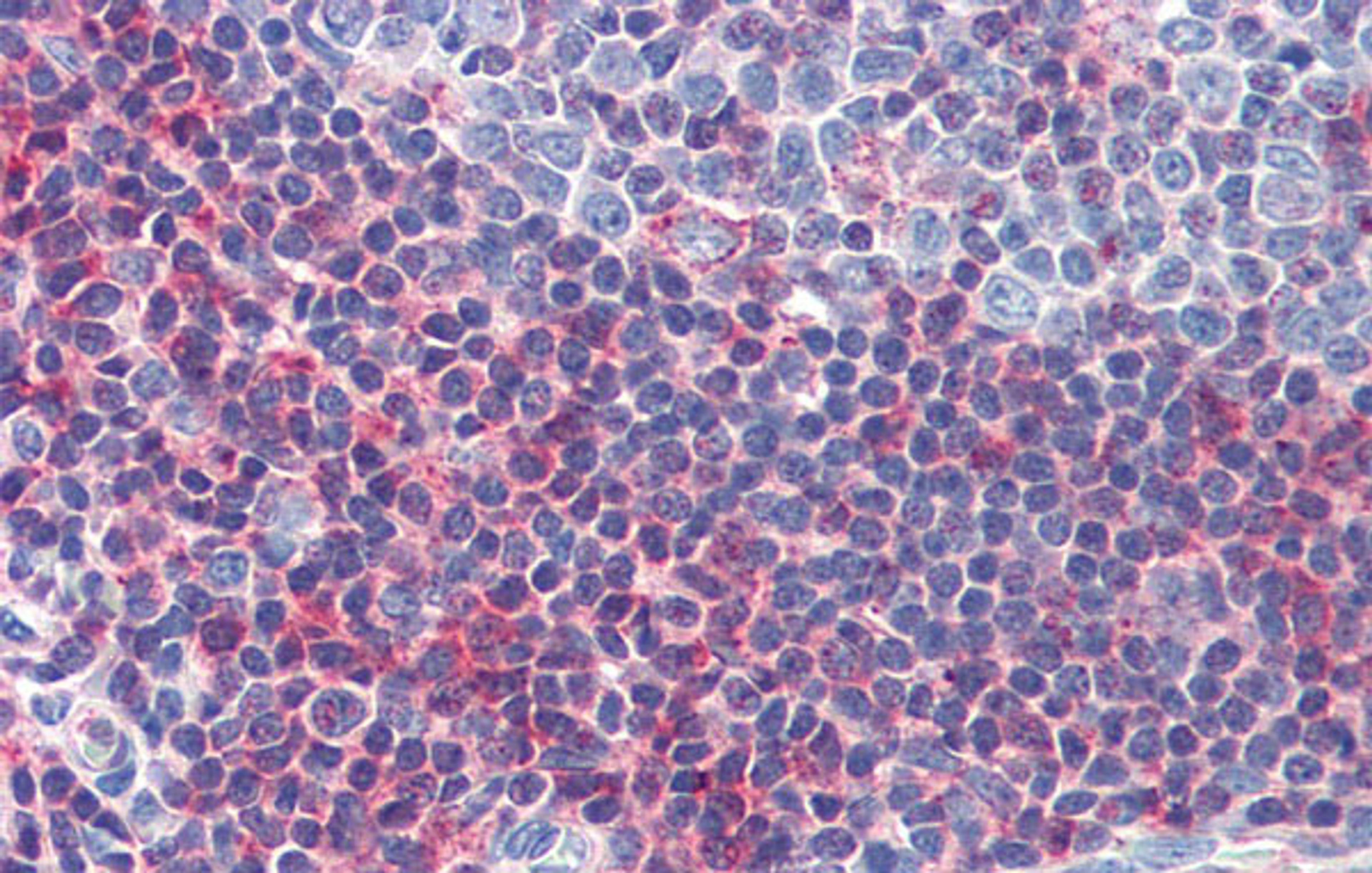 Antibody used in IHC on Human Tonsil at 5.0 ug/ml.