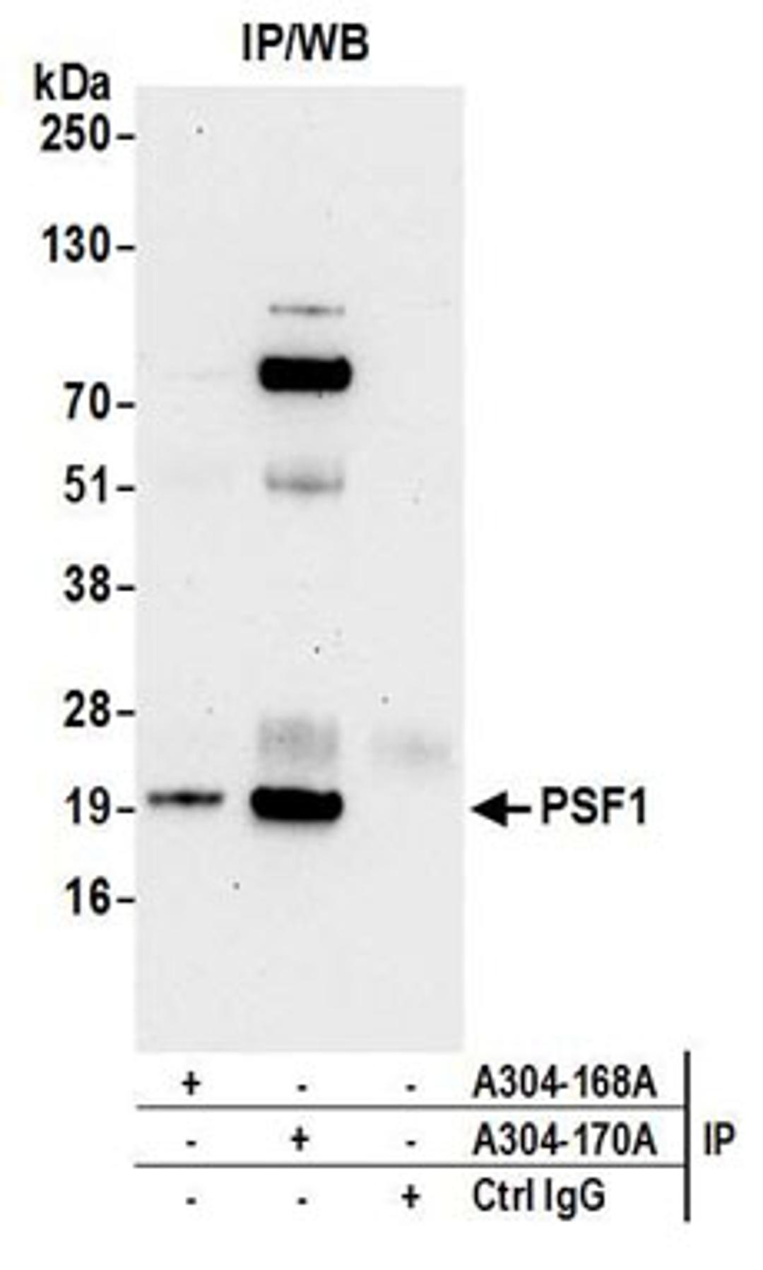 Detection of Human PSF1 by Western Blot of Immunoprecipitates.