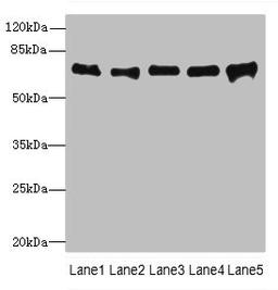 Western blot. All lanes: SPDL1 antibody at 4µg/ml. Lane 1: Hela whole cell lysate. Lane 2: 293T whole cell lysate. Lane 3: Jurkat whole cell lysate. Lane 4: A549 whole cell lysate. Lane 5: K562 whole cell lysate. Secondary. Goat polyclonal to rabbit IgG at 1/10000 dilution. Predicted band size: 71, 59, 62 kDa. Observed band size: 71 kDa
