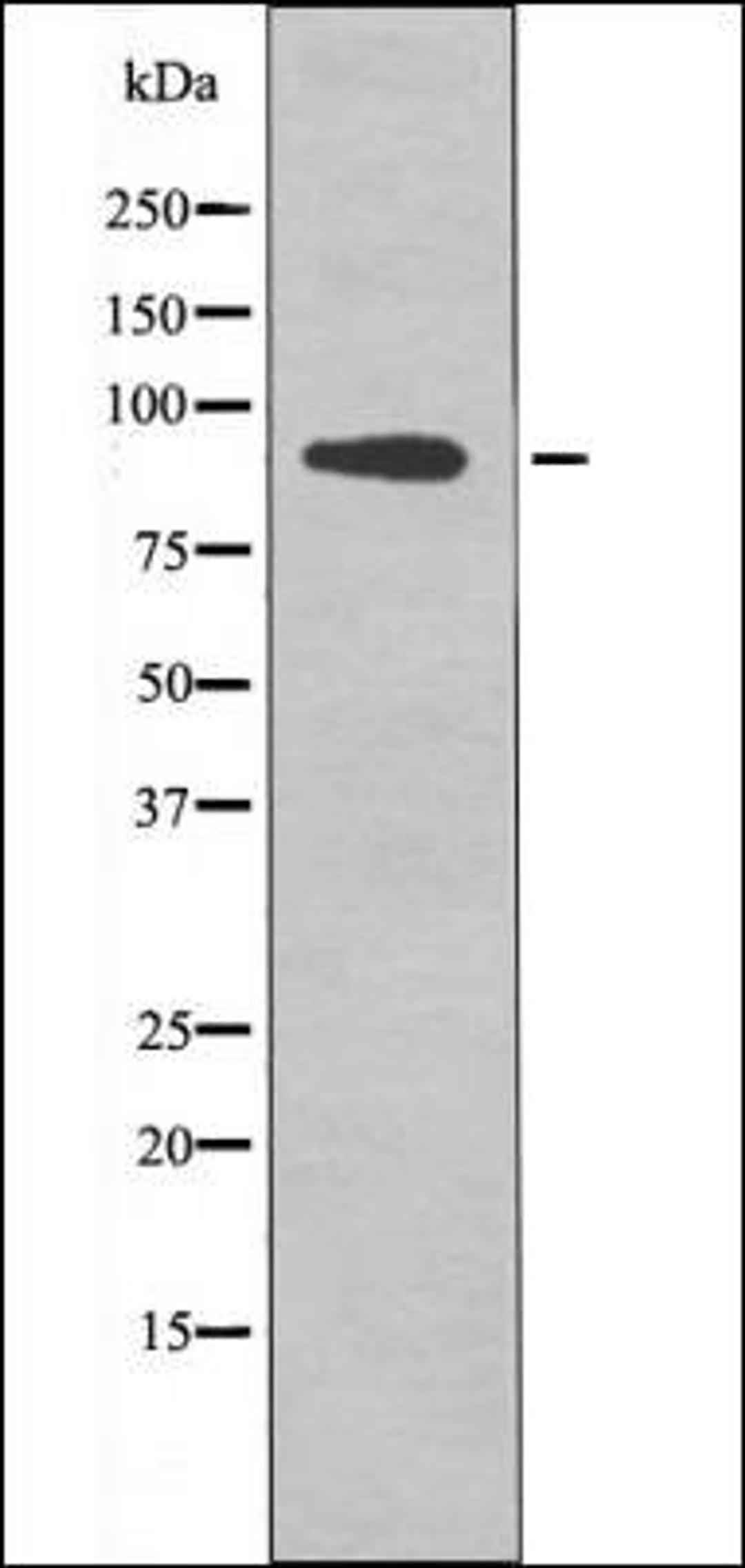 Western blot analysis of etoposide treated COS7 whole cell lysates using FGFR2 -Phospho-Tyr769- antibody