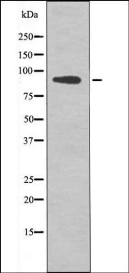 Western blot analysis of etoposide treated COS7 whole cell lysates using FGFR2 -Phospho-Tyr769- antibody