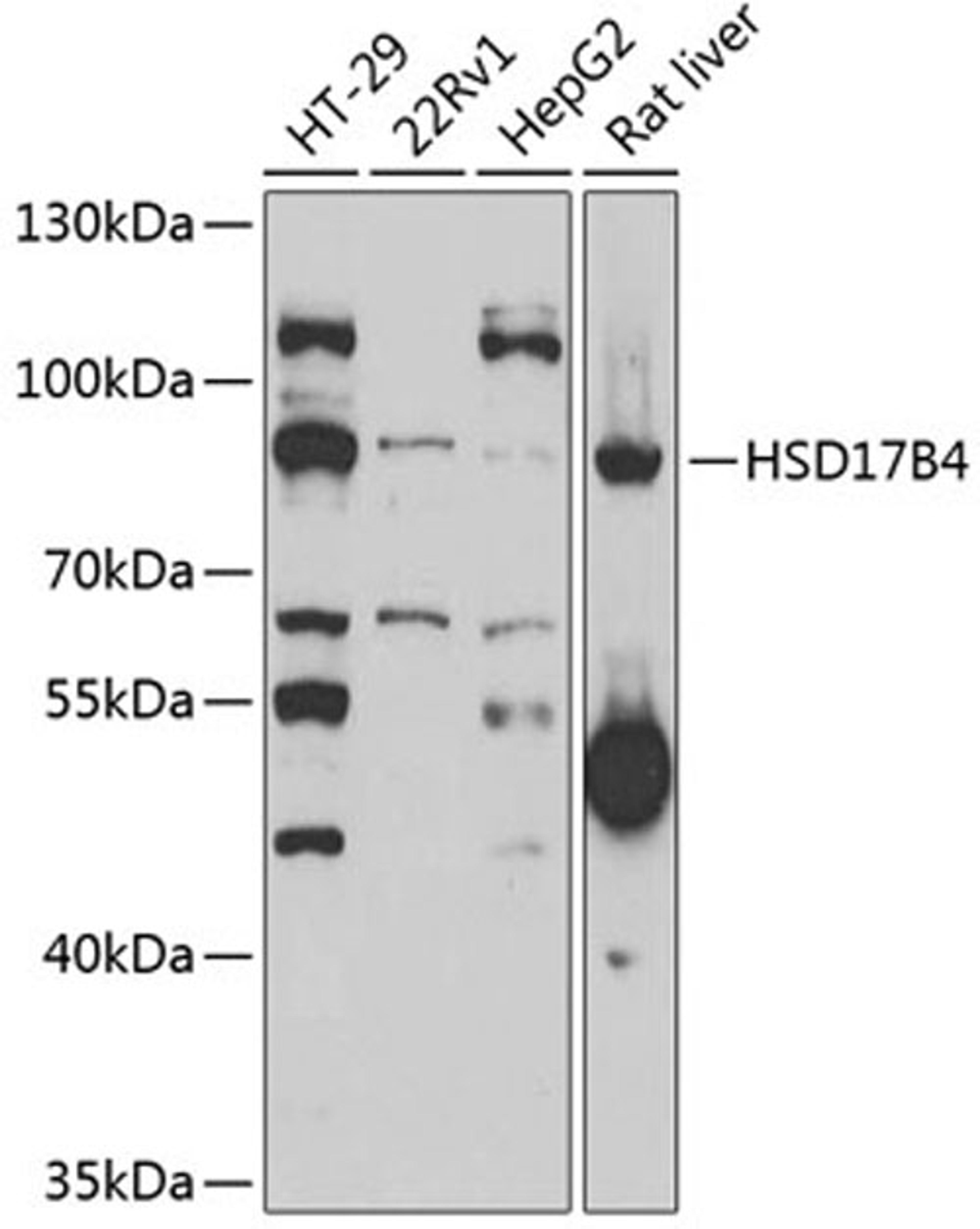 Western blot - HSD17B4 antibody (A6187)