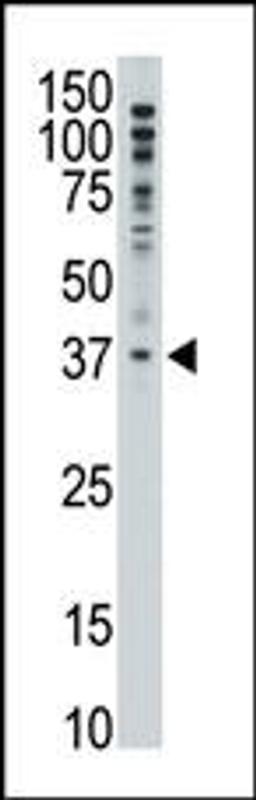 Antibody is used in Western blot to detect MAGEF1 in A375 lysate.