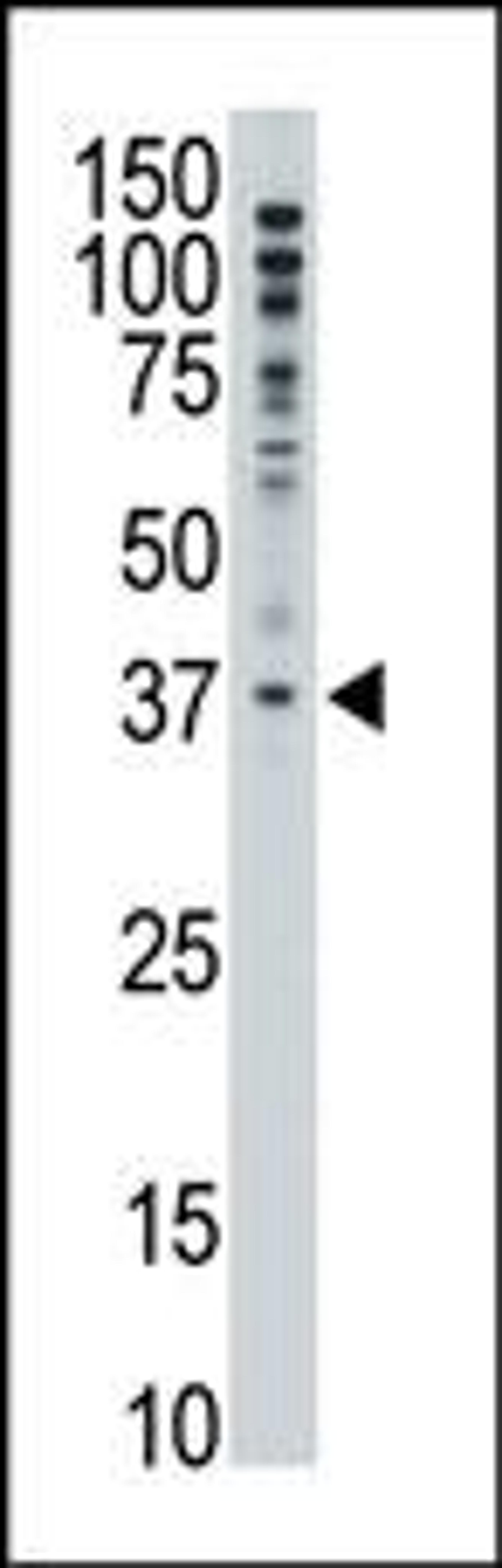 Antibody is used in Western blot to detect MAGEF1 in A375 lysate.