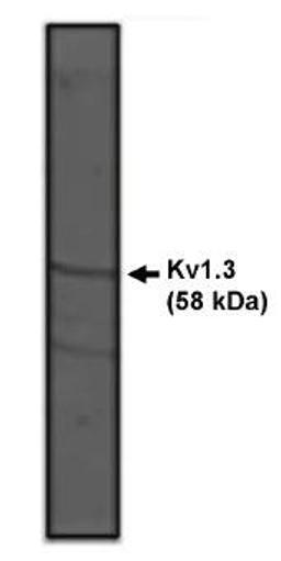 Western blot analysis of rat brain lysate using Kv1.3Potassium Channel antibody