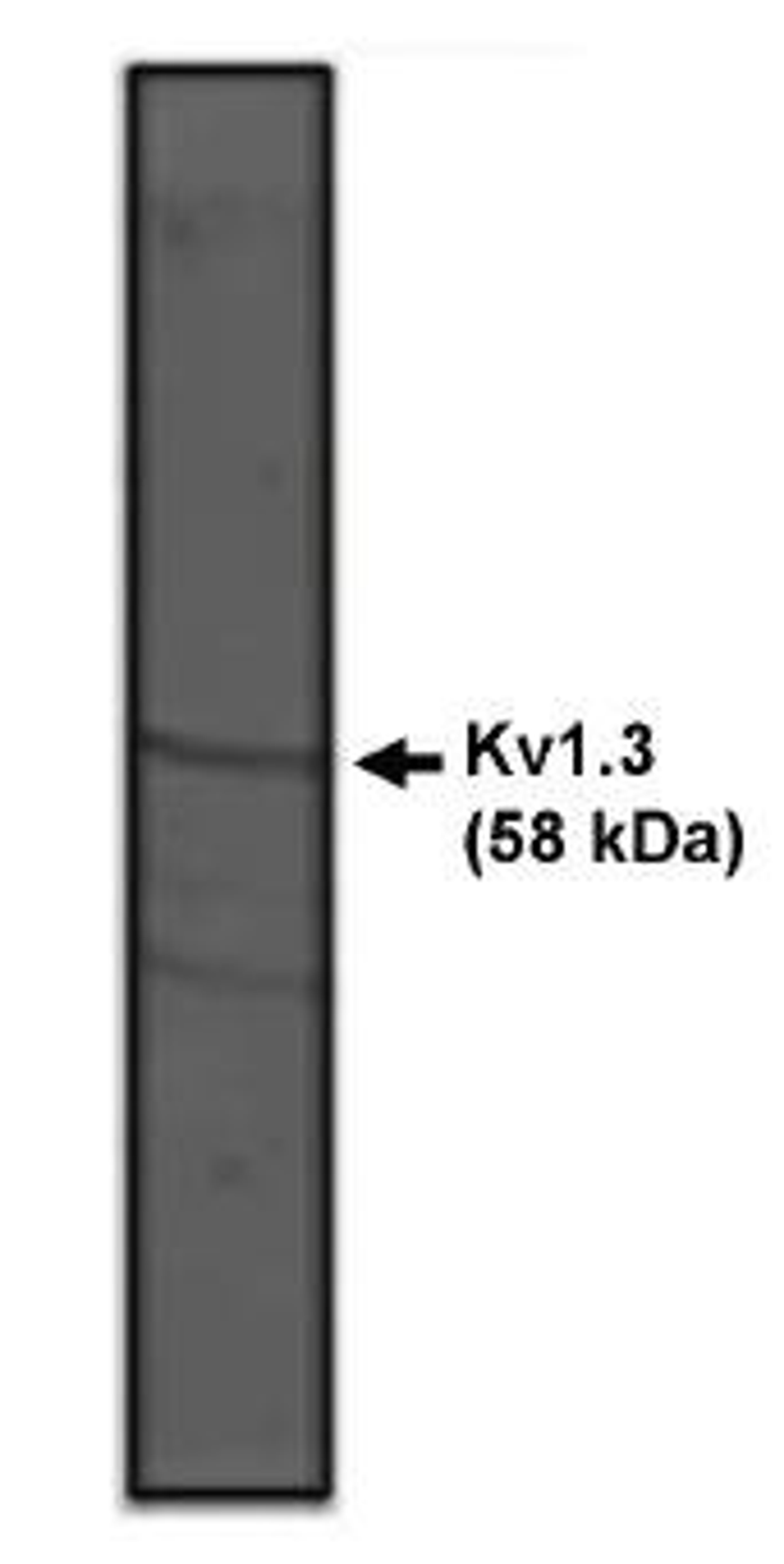 Western blot analysis of rat brain lysate using Kv1.3Potassium Channel antibody