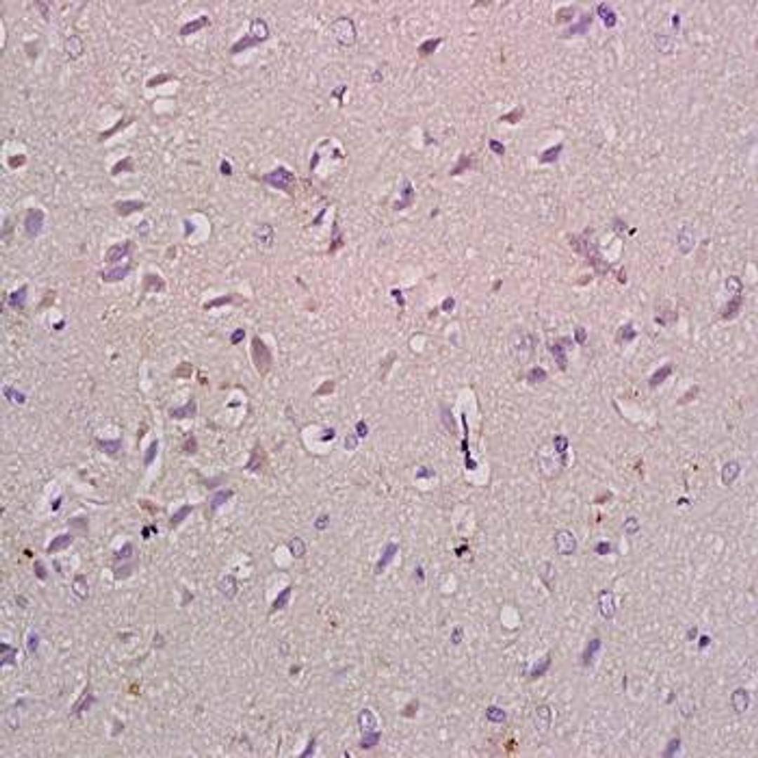 Immunohistochemical analysis of formalin-fixed and paraffin embedded rat brain tissue (dilution at:1:200) using Natriuretic Peptide Receptor B antibody