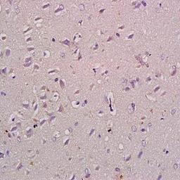 Immunohistochemical analysis of formalin-fixed and paraffin embedded rat brain tissue (dilution at:1:200) using Natriuretic Peptide Receptor B antibody