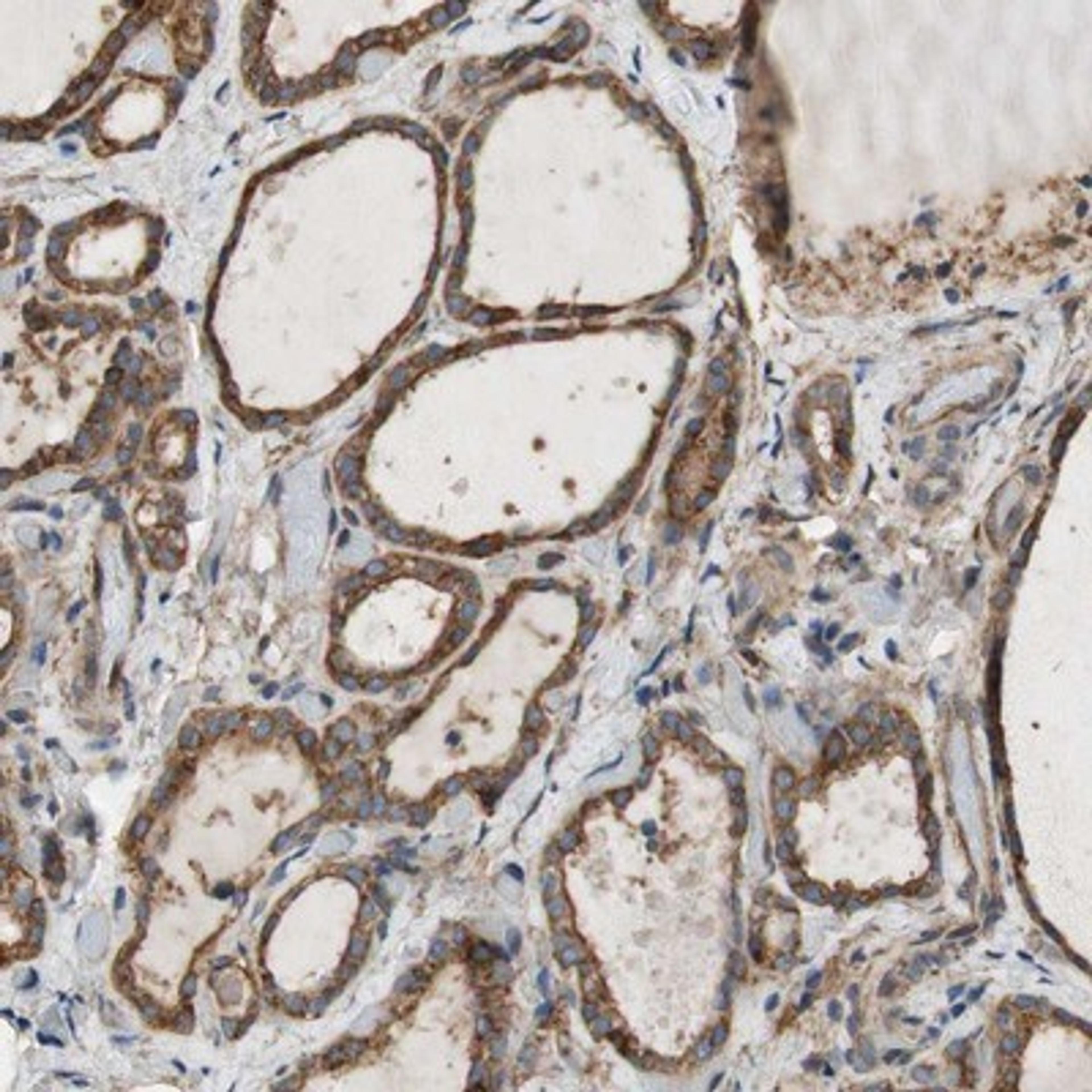 Immunohistochemistry-Paraffin: IL1RL1 Antibody [NBP1-85251] - Staining of human thyroid gland shows strong cytoplasmic positivity in glandular cells.