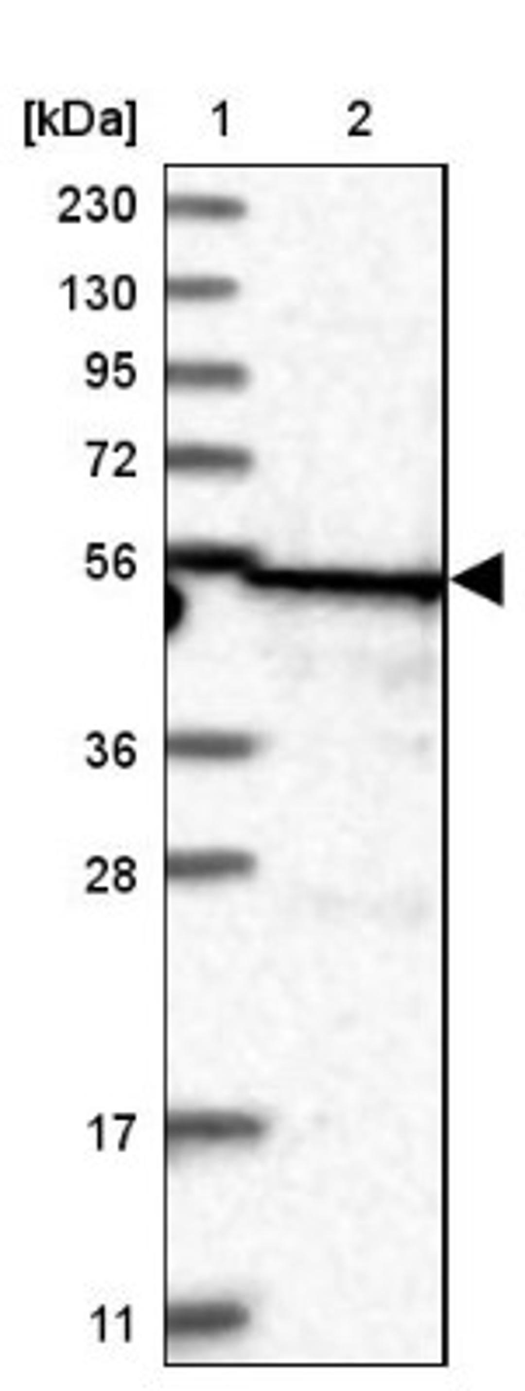 Western Blot: TRIT1 Antibody [NBP1-82210] - Lane 1: Marker [kDa] 230, 130, 95, 72, 56, 36, 28, 17, 11<br/>Lane 2: Human cell line RT-4